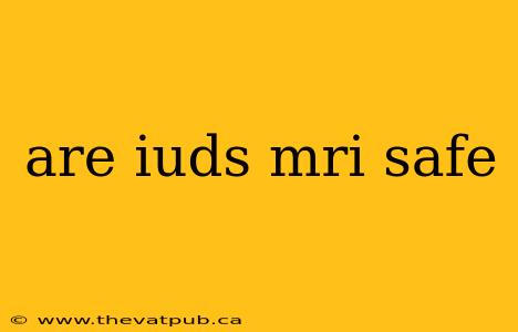 are iuds mri safe