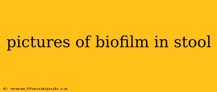 pictures of biofilm in stool