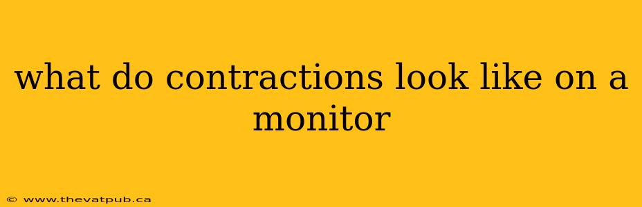 what do contractions look like on a monitor